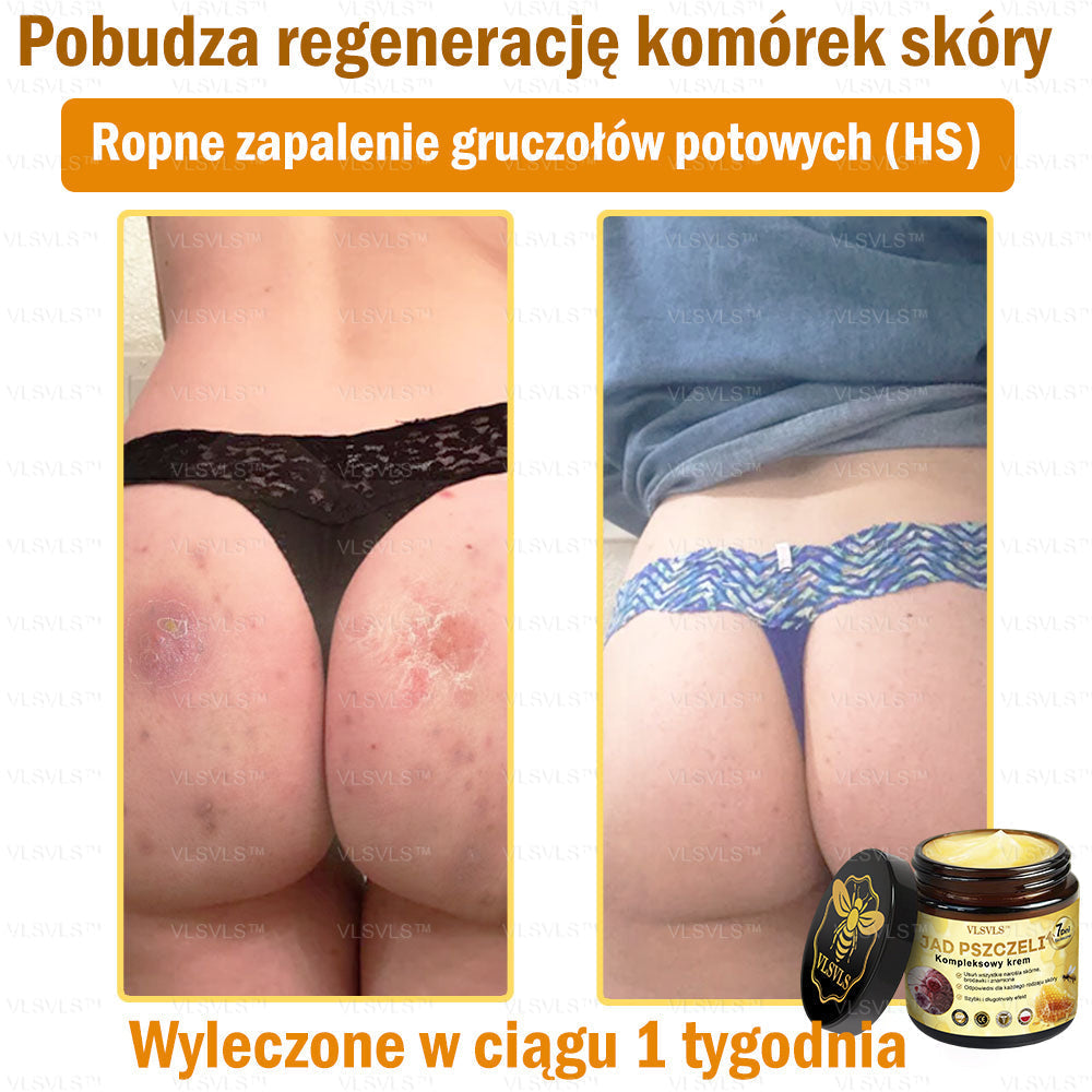 VLSVLS™ Krem Komprehensywny z Jadami Pszczół 🇵🇱 Rekomendowany przez Dermatologów🇵🇱