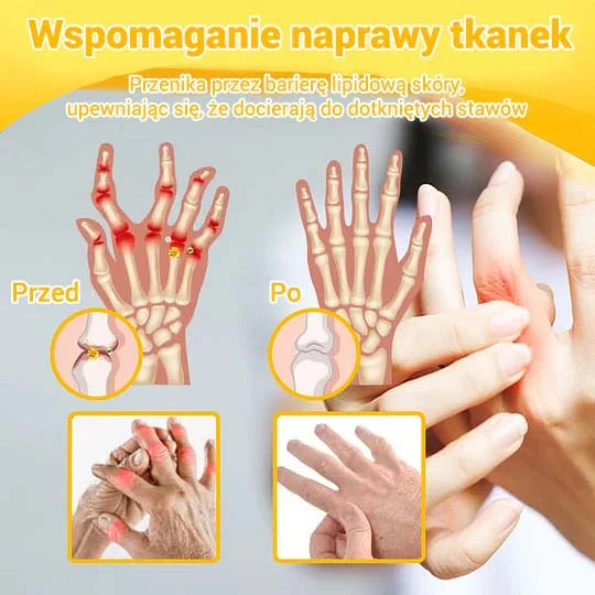 💎💎Krem Aeehfeng™ z zaawansowaną terapią stawów i kości na bazie jadu pszczelego (ekstrakt z pszczół nowozelandzkich - specjalizuje się w chorobach ortopedycznych i bólu stawów).
