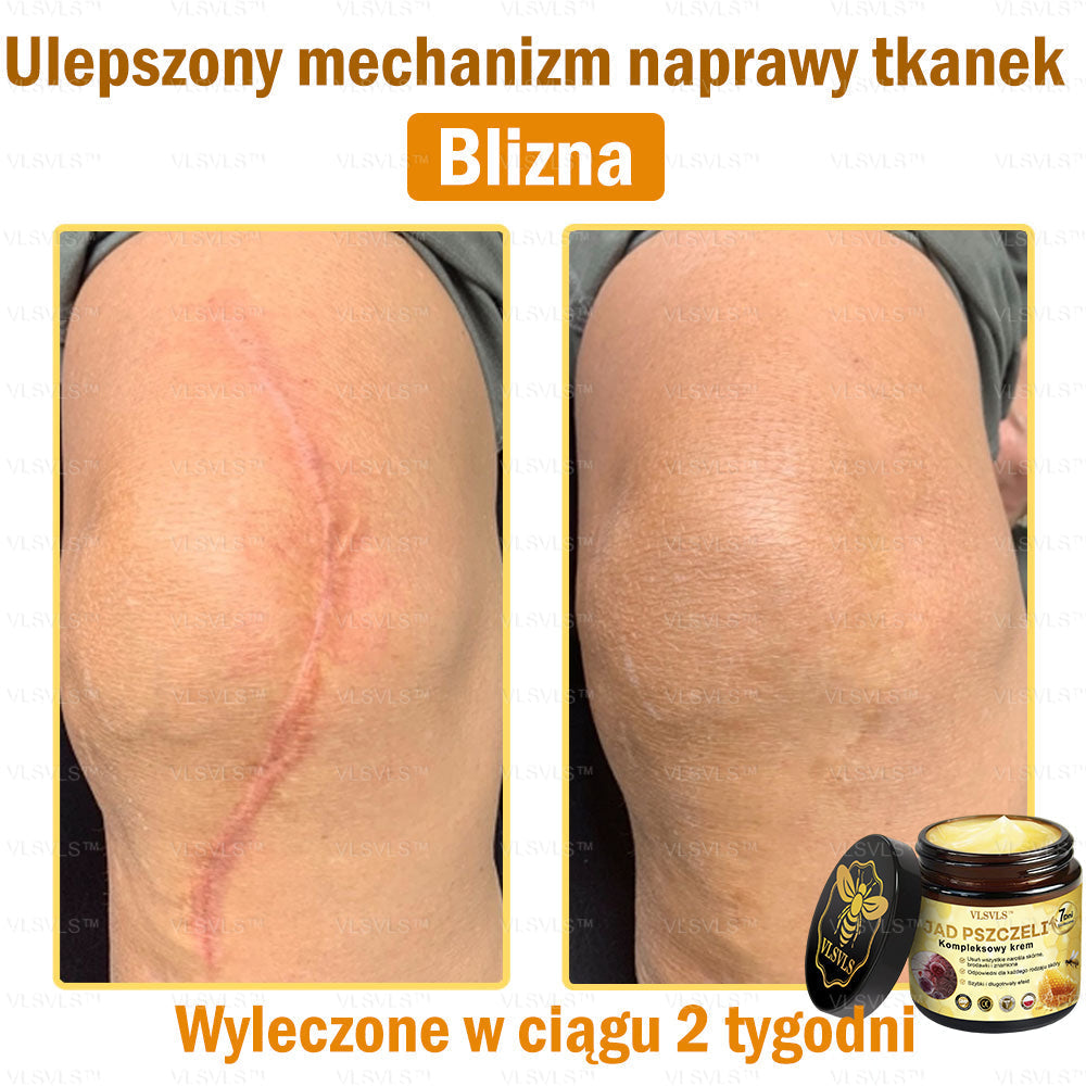 VLSVLS™ Krem Komprehensywny z Jadami Pszczół 🇵🇱 Rekomendowany przez Dermatologów🇵🇱