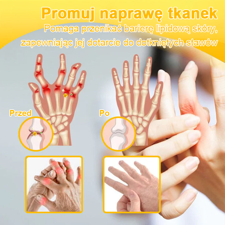 🦴TLOPA® Toksyna botulinowa i jad pszczeli Krem przeciwbólowy do gojenia kości🦴