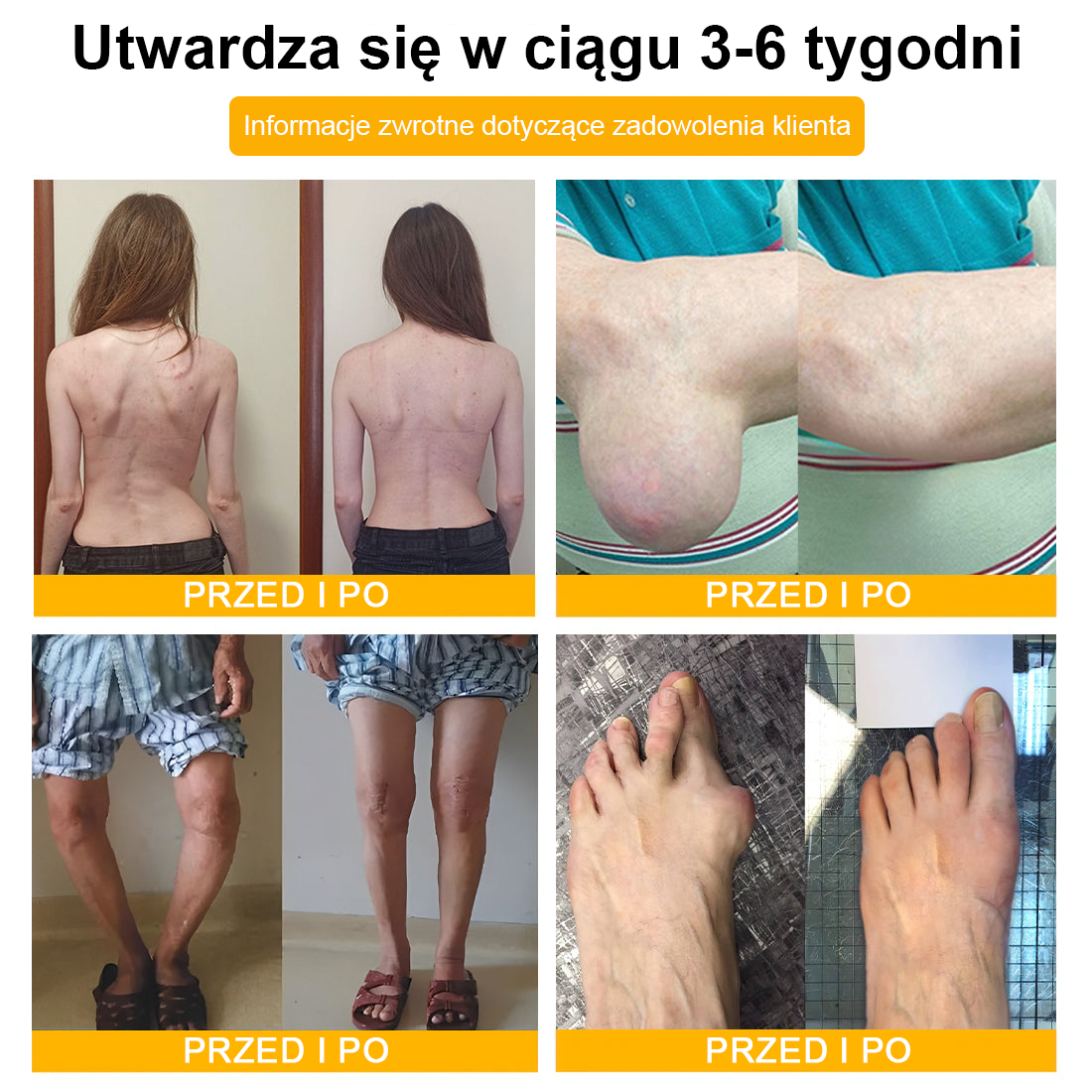 🦴TLOPA® Toksyna botulinowa i jad pszczeli Krem przeciwbólowy do gojenia kości🦴