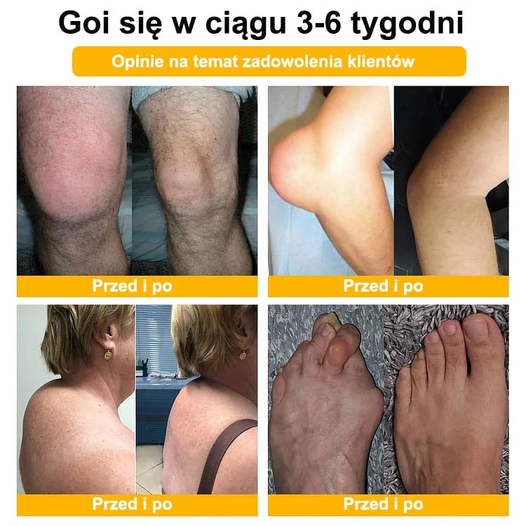 💎💎Krem Aeehfeng™ z zaawansowaną terapią stawów i kości na bazie jadu pszczelego (ekstrakt z pszczół nowozelandzkich - specjalizuje się w chorobach ortopedycznych i bólu stawów).