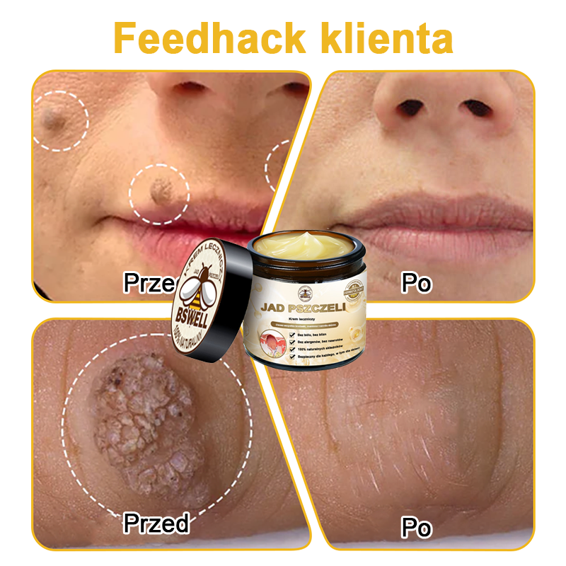 🐝✨𝑩𝑺𝑾𝑬𝑳𝑳® Krem z jadami pszczół 👨⚕️ (Rekomendacja dermatologów) (🔥Ostatni dzień promocji, 80% zniżki)
