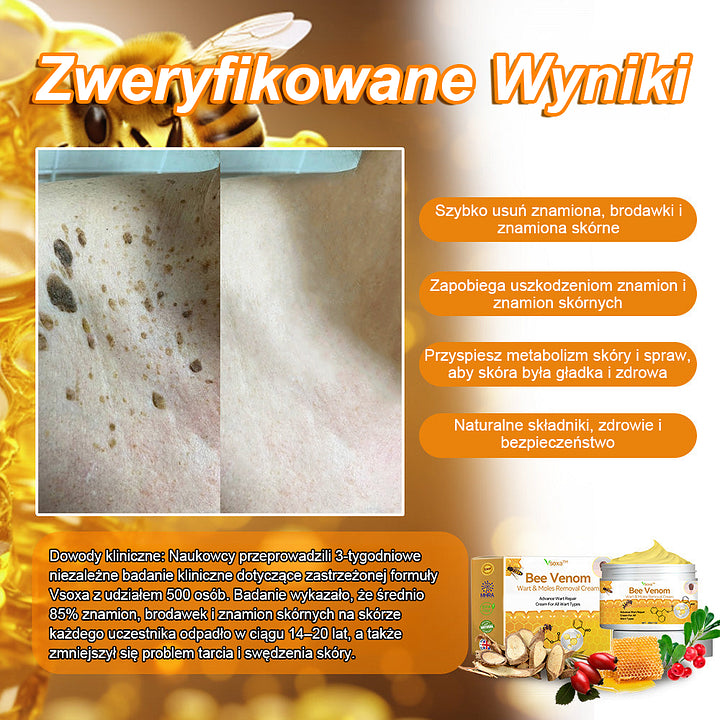 【🌊 Za pobraniem🌊 】 Vsoxa™ Krem do usuwania brodawek i pieprzyków z jadem pszczelim (👨⚕Zalecenia AAD) 🐝🐝 (🔥Ostatni dzień wyprzedaży 70% taniej)