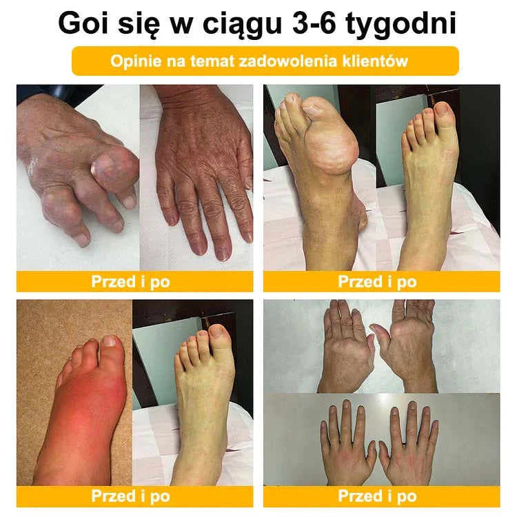 💎💎Krem Aeehfeng™ z zaawansowaną terapią stawów i kości na bazie jadu pszczelego (ekstrakt z pszczół nowozelandzkich - specjalizuje się w chorobach ortopedycznych i bólu stawów).