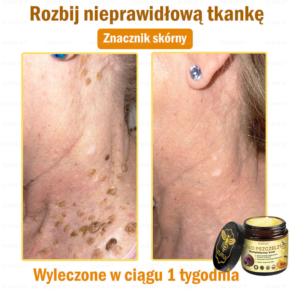 VLSVLS™ Krem Komprehensywny z Jadami Pszczół 🇵🇱 Rekomendowany przez Dermatologów🇵🇱