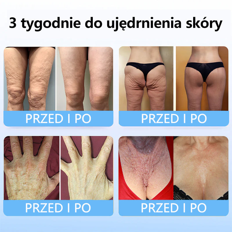 TLOPA™ Kolagen Peptydy UJĘDRNIAJĄCE SERUM W SZTYFCIE🎄🎄🎄 – Państwowy Zakład Higieny (PZH) oraz Polskie Towarzystwo Dermatologiczne (PTD), gwarantujące najwyższą jakość i bezpieczeństwo dla Twojej skóry.