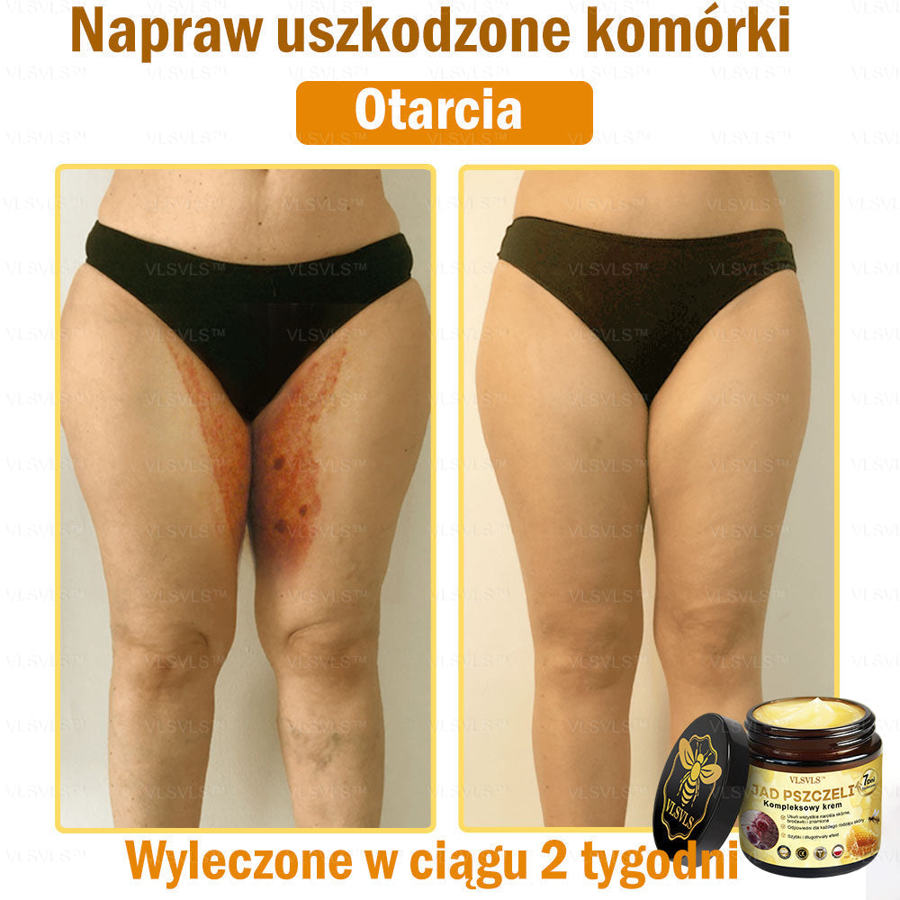 VLSVLS™ Krem Komprehensywny z Jadami Pszczół 🇵🇱 Rekomendowany przez Dermatologów🇵🇱