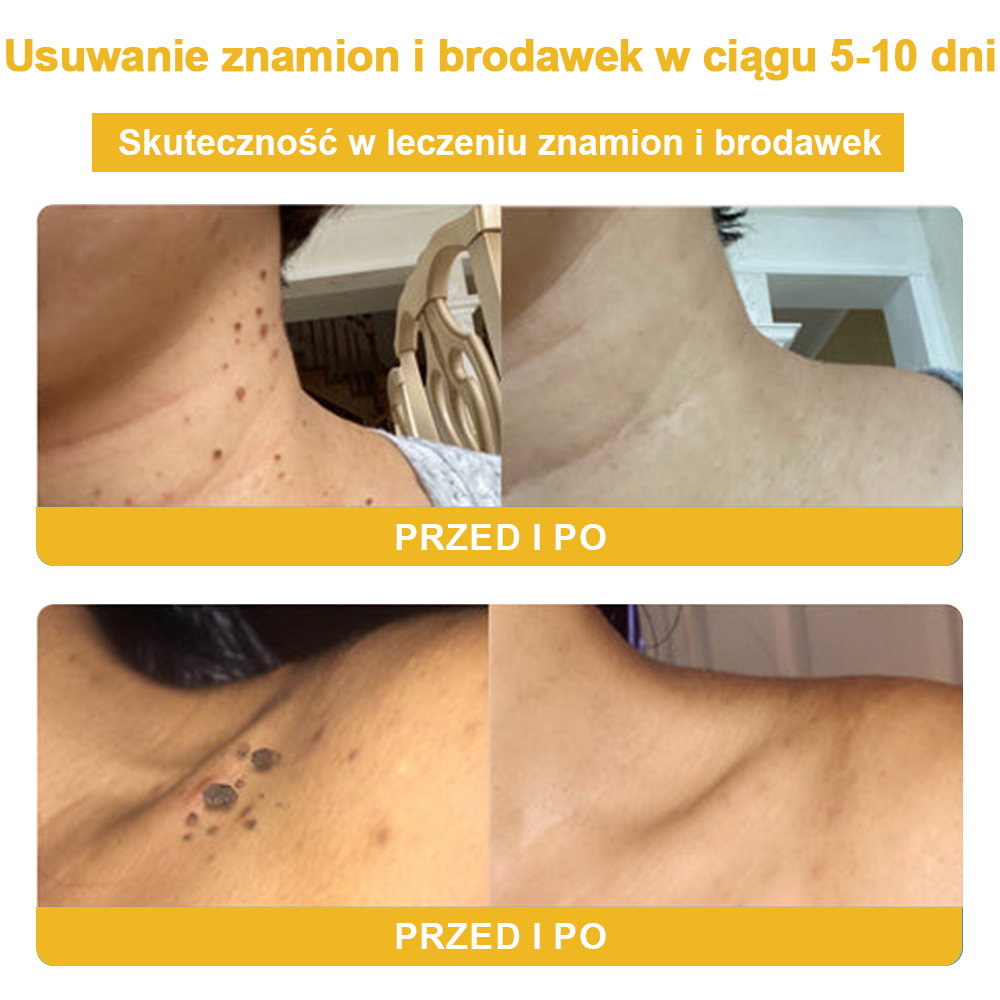 🏵️Turonu™ leczniczy krem do skóry z jadem pszczelim (zalecany przez AAD)