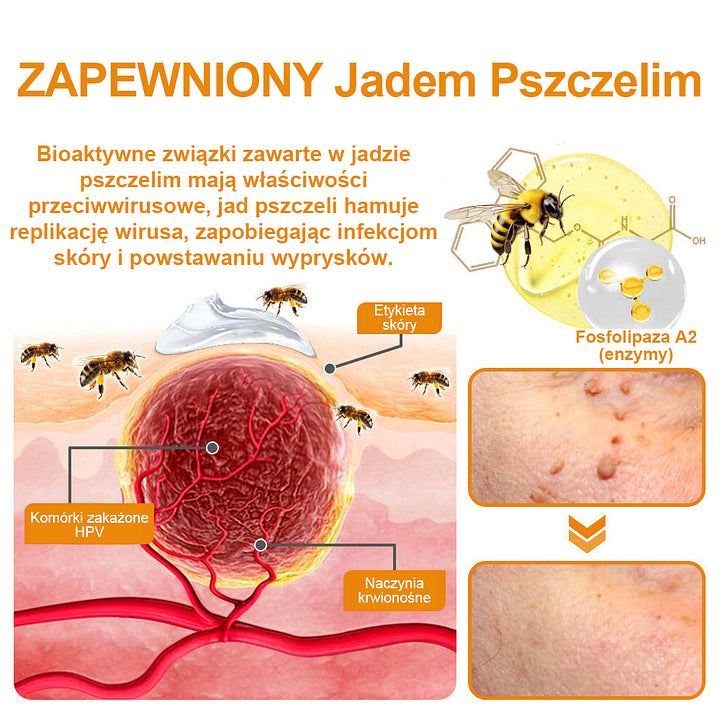 【🌊 Za pobraniem🌊 】 Vsoxa™ Krem do usuwania brodawek i pieprzyków z jadem pszczelim (👨⚕Zalecenia AAD) 🐝🐝 (🔥Ostatni dzień wyprzedaży 70% taniej)
