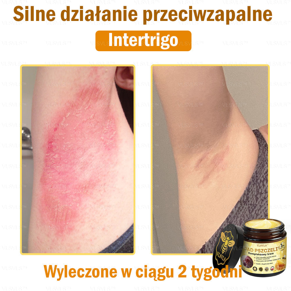 VLSVLS™ Krem Komprehensywny z Jadami Pszczół 🇵🇱 Rekomendowany przez Dermatologów🇵🇱