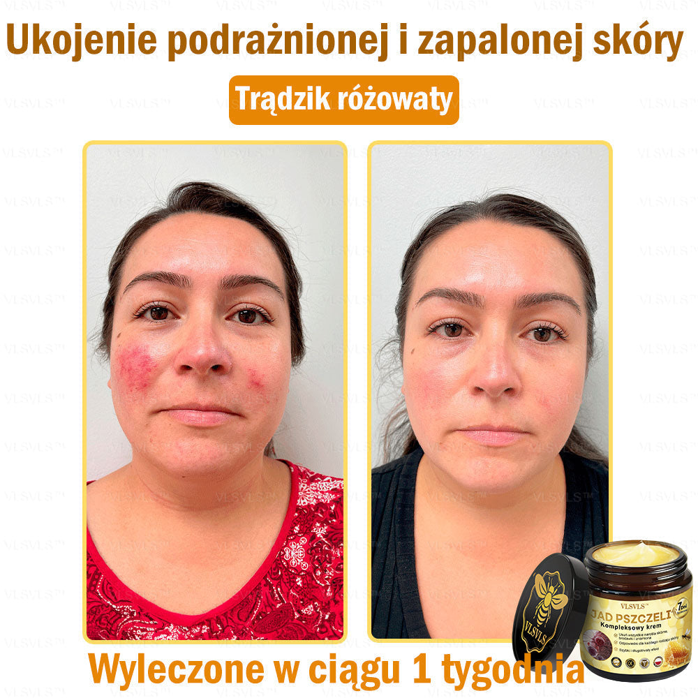 VLSVLS™ Krem Komprehensywny z Jadami Pszczół 🇵🇱 Rekomendowany przez Dermatologów🇵🇱