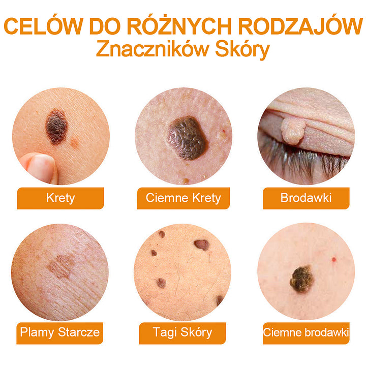 【🌊 Za pobraniem🌊 】 Vsoxa™ Krem do usuwania brodawek i pieprzyków z jadem pszczelim (👨⚕Zalecenia AAD) 🐝🐝 (🔥Ostatni dzień wyprzedaży 70% taniej)