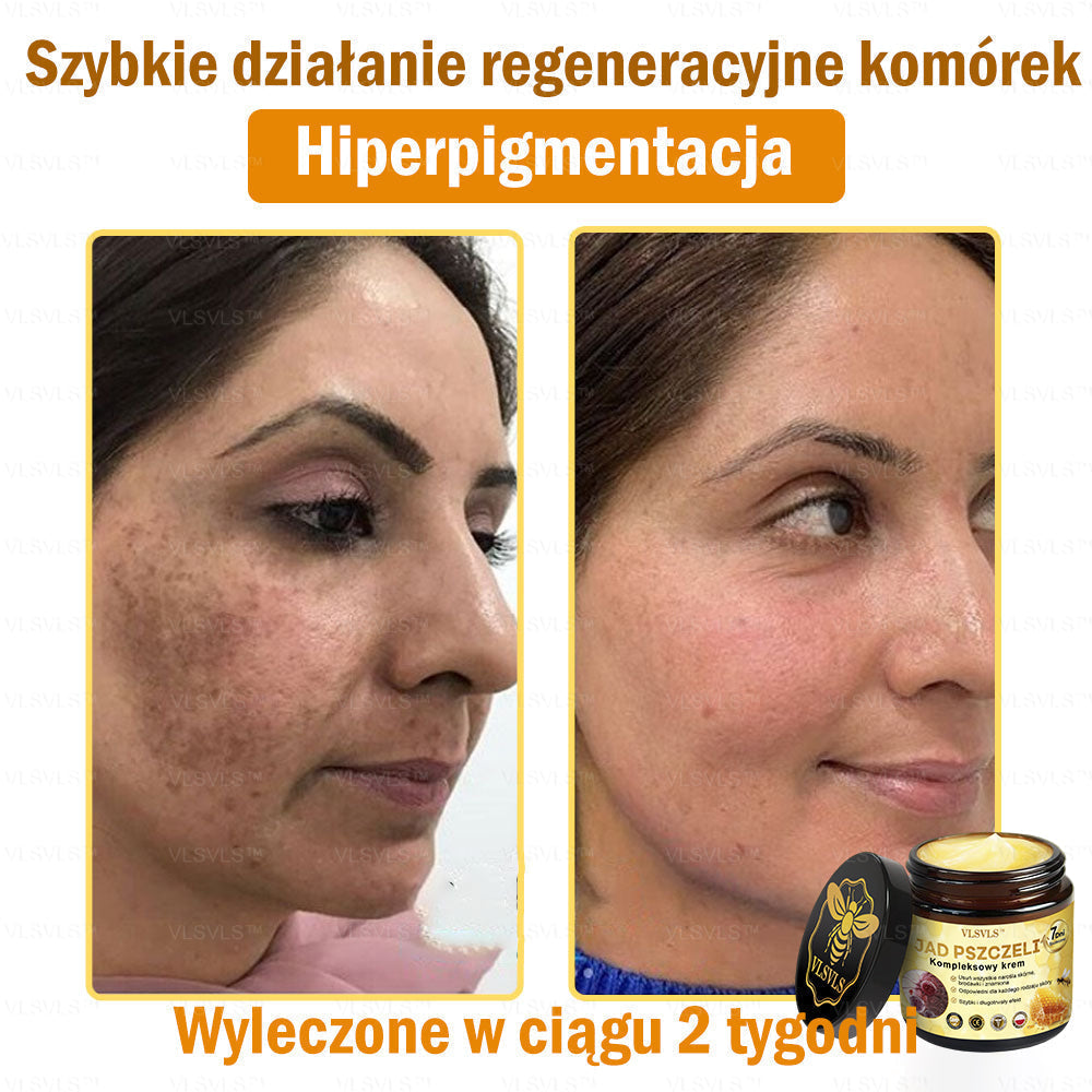 VLSVLS™ Krem Komprehensywny z Jadami Pszczół 🇵🇱 Rekomendowany przez Dermatologów🇵🇱
