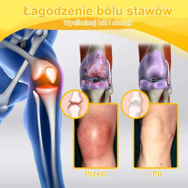 💎💎Krem Aeehfeng™ z zaawansowaną terapią stawów i kości na bazie jadu pszczelego (ekstrakt z pszczół nowozelandzkich - specjalizuje się w chorobach ortopedycznych i bólu stawów).