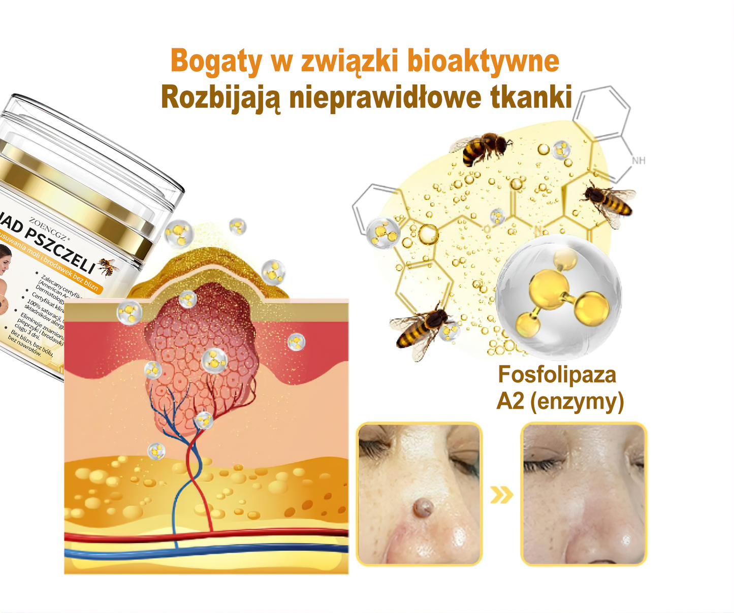 👨⚕️👨⚕️𝐙𝐨𝐞𝐧𝐜𝐠𝐳™ 𝐤𝐫𝐞𝐦 𝐳 𝐣𝐚𝐝𝐞𝐦 𝐩𝐬𝐳𝐜𝐳𝐞𝐥𝐢𝐦 𝐧𝐚 𝐳𝐧𝐚𝐦𝐢𝐨𝐧𝐚 𝐢 𝐛𝐫𝐨𝐝𝐚𝐰𝐤𝐢(𝐑𝐞𝐤𝐨𝐦𝐞𝐧𝐝𝐚𝐜𝐣𝐚 𝐏𝐓𝐃)