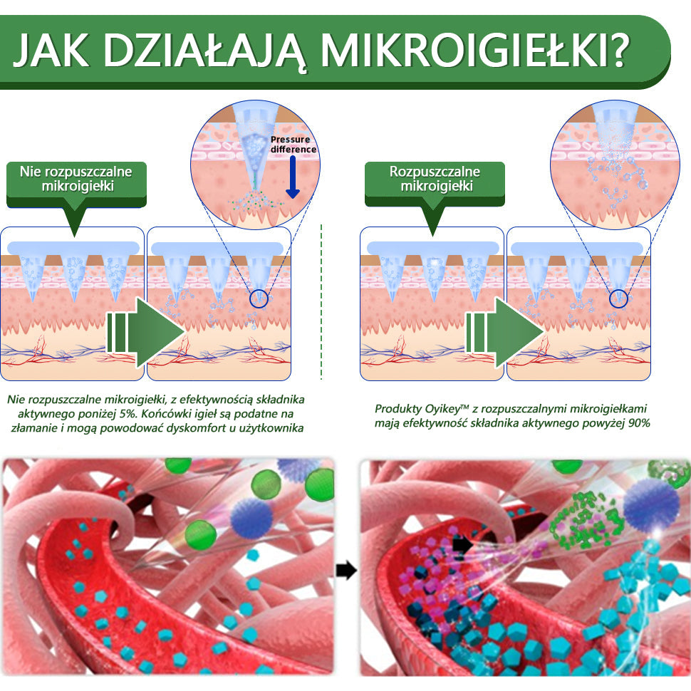 [Zobacz wyniki w ciągu 7 dni]🌻𝗧𝗟𝗢𝗣𝗔® 𝗚𝗟𝗣-𝟭 Nano Microneedle Patch🎀(Bezbolesny, długotrwały, zwalczający cukrzycę, otyłość i choroby układu krążenia)