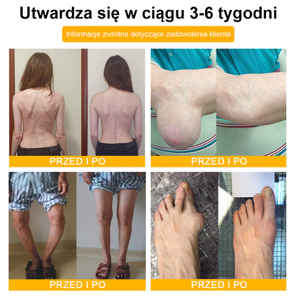 🦴TLOPA® Toksyna botulinowa i jad pszczeli Krem przeciwbólowy do gojenia kości🦴