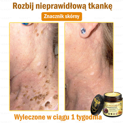🇵🇱VLSVLS™ Krem Komprehensywny z Jadami Pszczół 🇵🇱 Rekomendowany przez Dermatologów🇵🇱