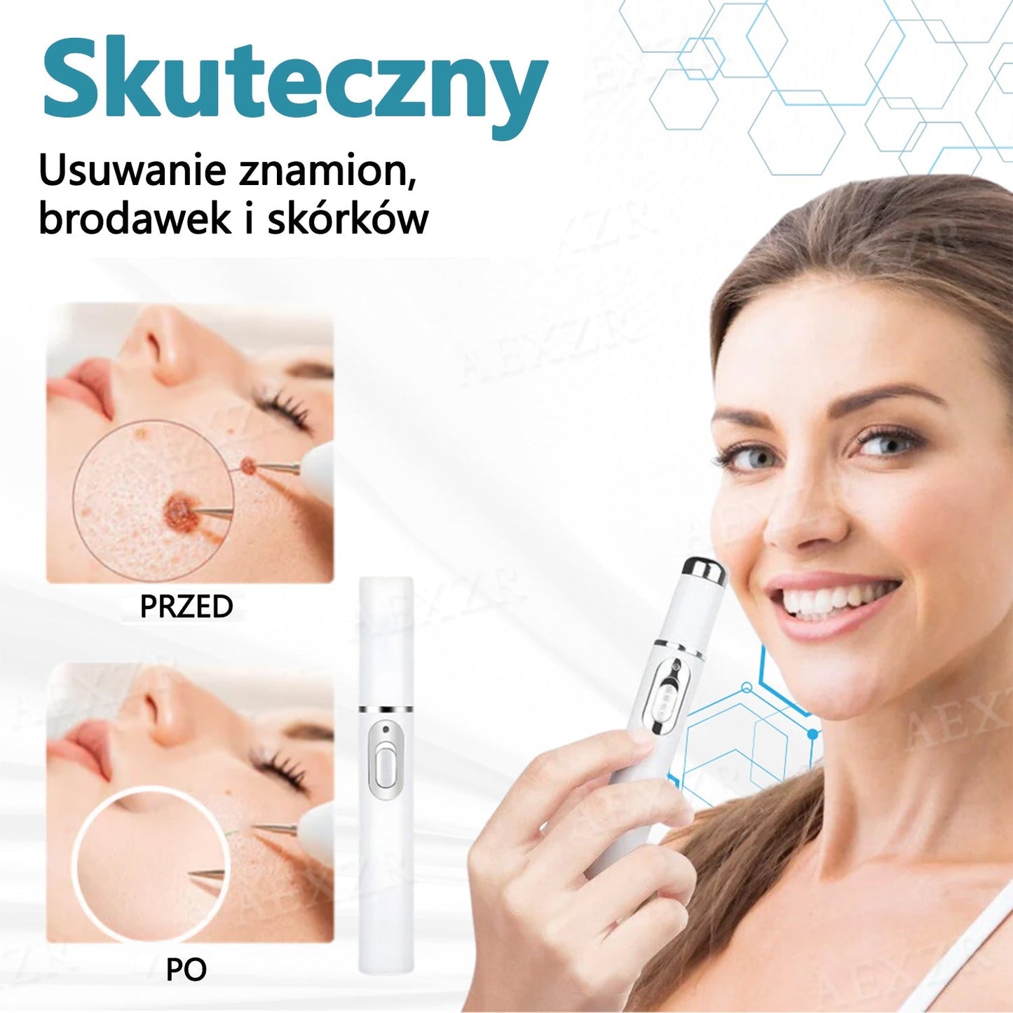 🏆Cvreoz® nowy nieinwazyjny laser do usuwania pieprzyków i brodawek🏆