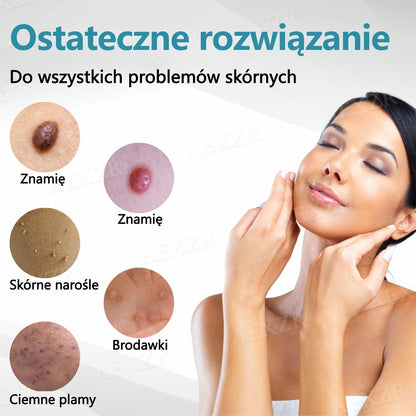 🏆Cvreoz® nowy nieinwazyjny laser do usuwania pieprzyków i brodawek🏆